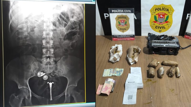 Boliviana que engoliu drogas é presa pela DISE de Franca