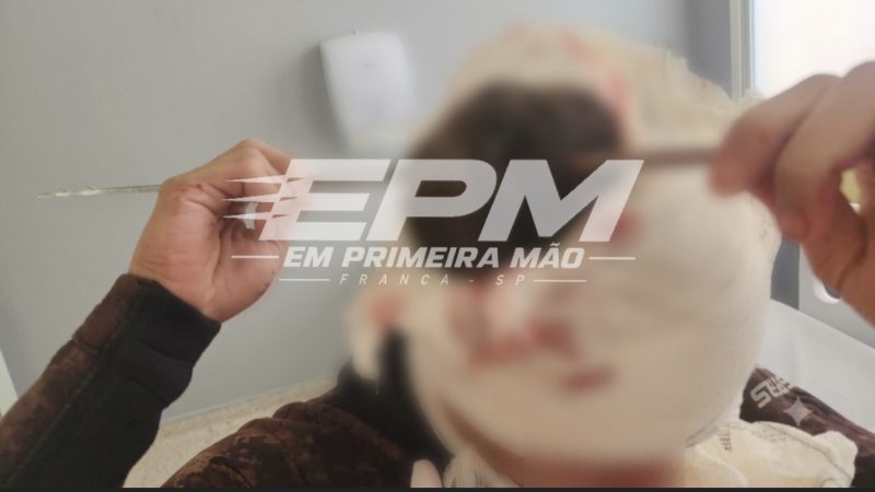 Pescaria por pouco não termina em tragédia em Rifaina; jovem leva tiro de arpão na cabeça